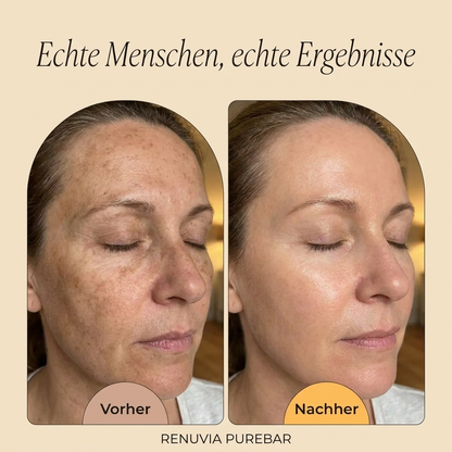 PureBar — Pflegeseife mit Kurkuma & Vitamin E