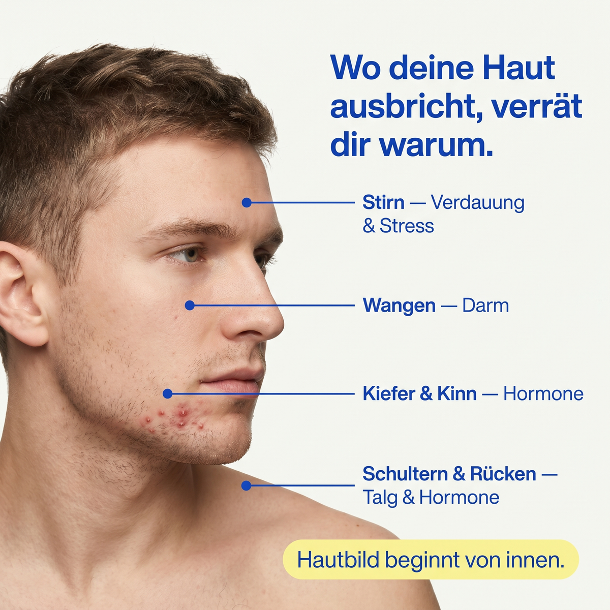 Clear™ Skin Support