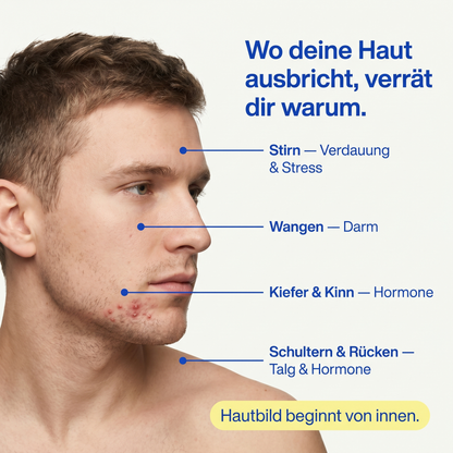Clear™ Skin Support