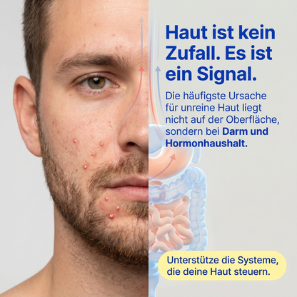 Clear™ Skin Support